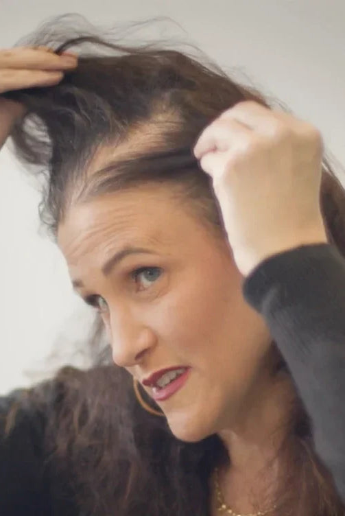 Disadvantages of Hair Toppers for Thinning Hair and What You Should Know