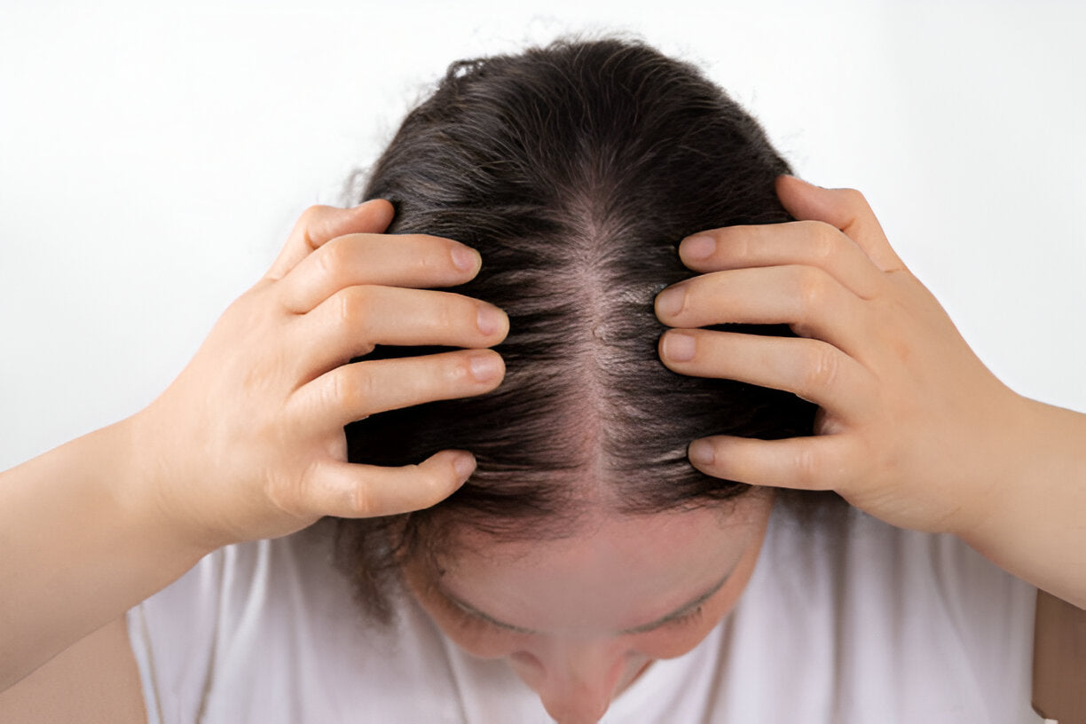 Why a Receding Hairlines in Women and What You Can Do?